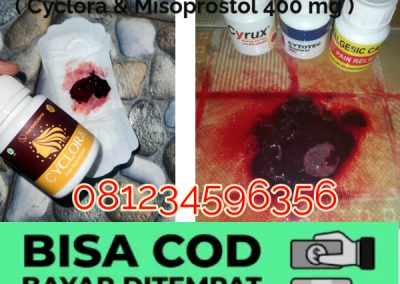 7 Nama Obat Aborsi Penggunaan Cytotec Sebagai Obat Penggugur Kandungan