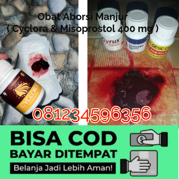 7 Nama Obat Aborsi Penggunaan Cytotec Sebagai Obat Penggugur Kandungan