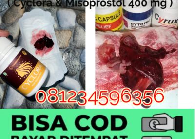 Apakah Obat Cytotec Sebagai Obat Penggugur Kandungan Untuk Kesehatan Wanita
