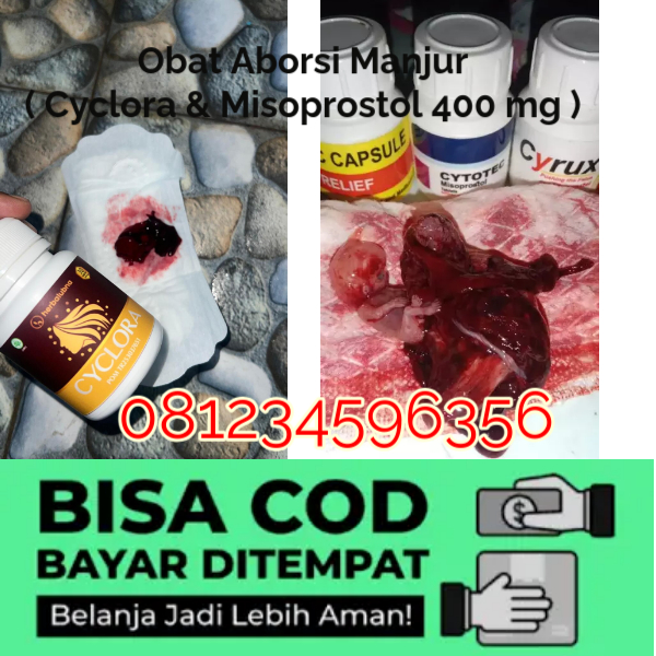 Apakah Obat Cytotec Sebagai Obat Penggugur Kandungan Untuk Kesehatan Wanita