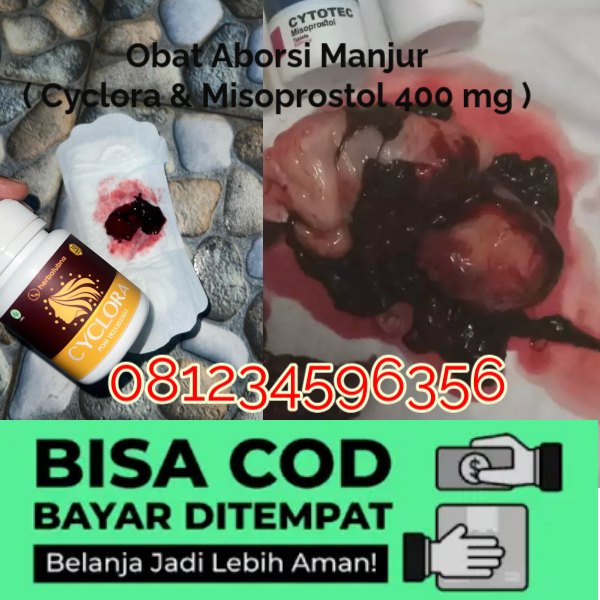 3 Obat Aborsi Populer di Apotek Panduan Perbedaan Cytotec Misoprostol dan Gastrul